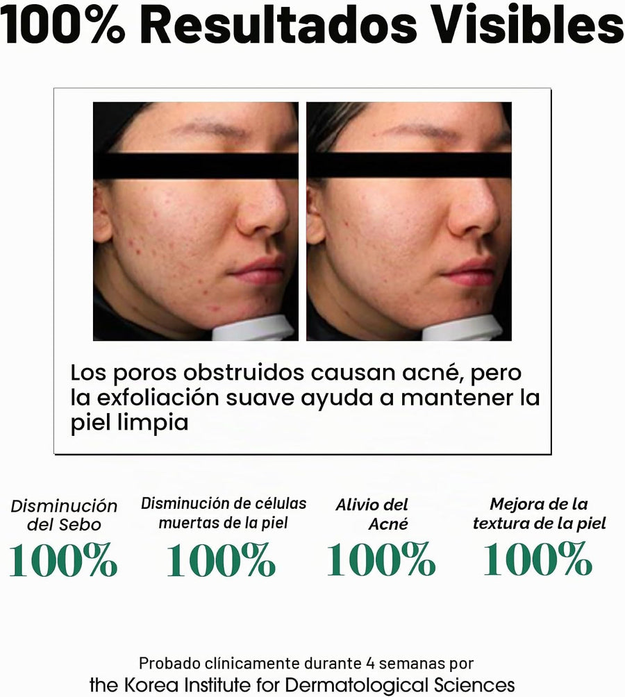 Tónico Exfoliante AHA BHA PHA Some By Mi detalle del envase y la tapa.