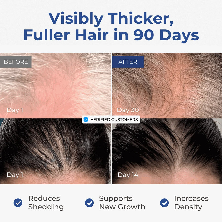 GHK-Cu Copper Peptide Hair & Scalp Serum resultados antes y después.