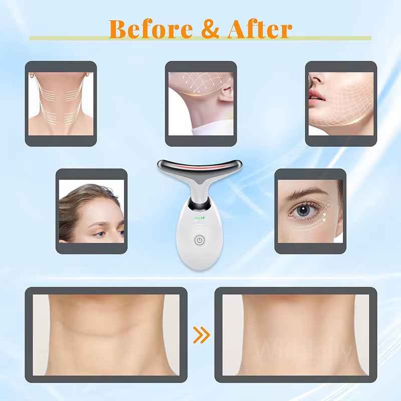 Masajeador Facial y Cuello LED con Microcorrientes EMS