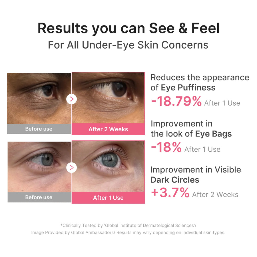 Parche de Ojos PDRN Cafeína y Colágeno Medicube aplicación.