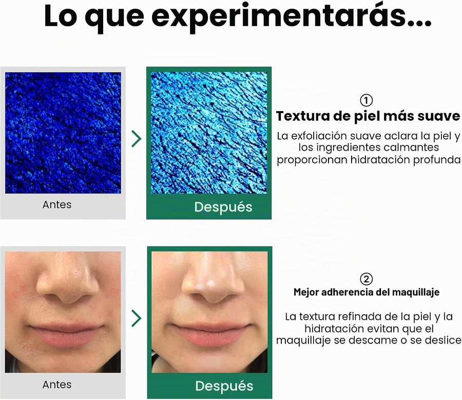 Tónico Exfoliante AHA BHA PHA Some By Mi presentación completa del producto.